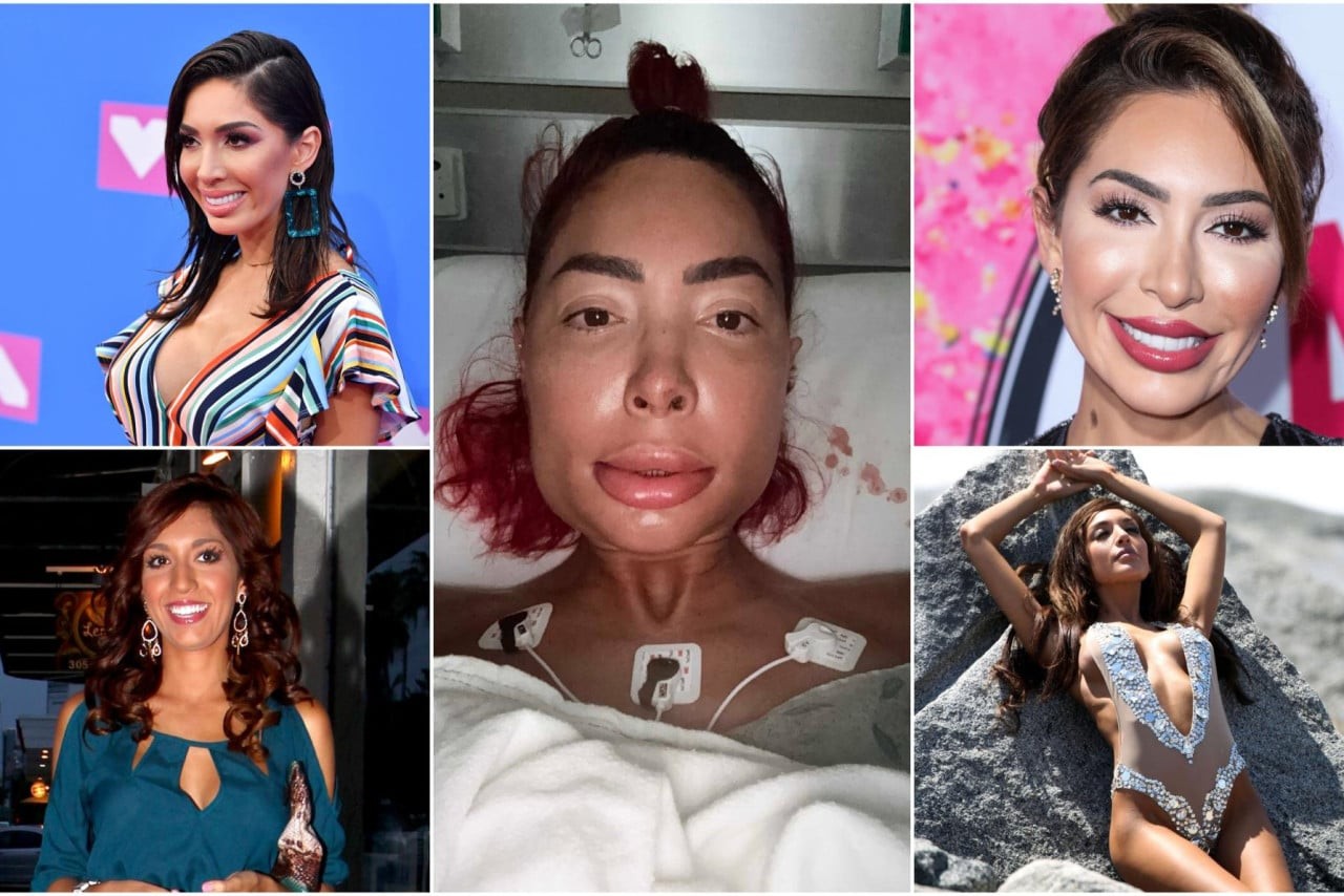Farrah Abraham nakon strašne operacije čeljusti: 'Osjećam se kao Frankenstein'